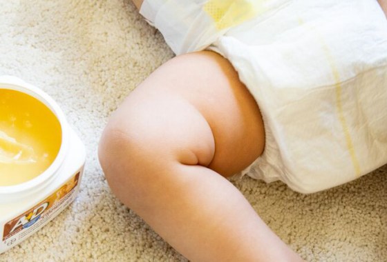 Best Diaper Rash Creams