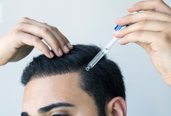 Best essential oils for dandruff