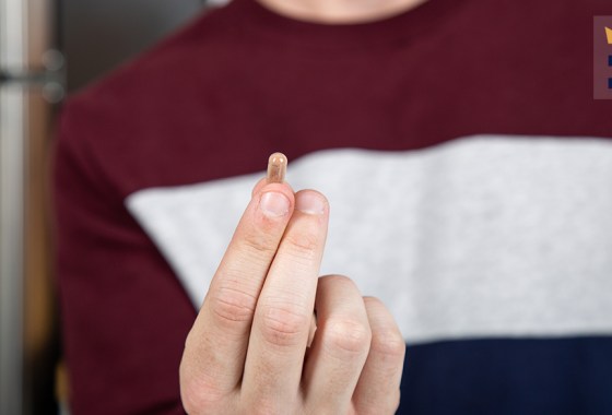 Best amino acid supplement