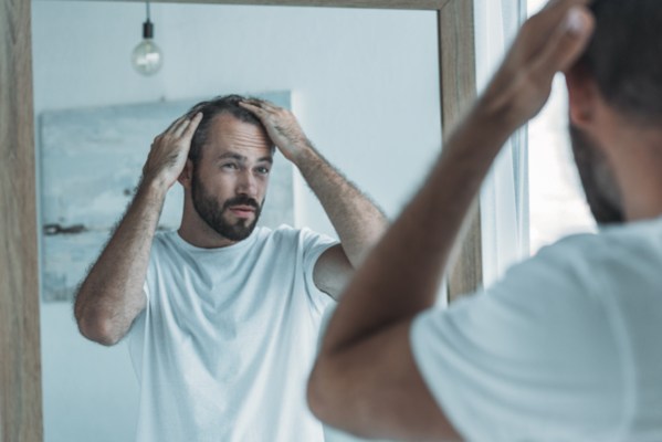 hair loss1